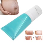 100g Stretch Marks Cream Postpartum Care Stretch Marks Scar Removal Repairin SG5