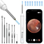 VITCOCO Ear Wax Removal Kit, 1920P HD Ear Cleaner with Camera Ear Wax Remover Tool, WiFi Otoscope with 6 LED Lights & 8 Ear Spoons, Visual Ear Scope for iPhone iPad Android Adults Kids Pets