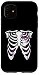 iPhone 11 Lean, Purple Drank, Dirty Double cup, Lean Line Bones rib Case