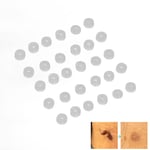 Skin Tag Removal Accessories 30pcs Easy Use Skin Tag Remover Rubber Ring For All