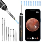 VITCOCO Ear Wax Removal Kit, 1920P HD Ear Cleaner with Camera Ear Wax Remover Tool, WiFi Otoscope with 6 LED Lights & 8 Ear Spoons, Visual Ear Scope for iPhone iPad Android Adults Kids Pets(Black)