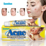 30g Acne Removal Cream Pimple Pits Pustule Deep Cleaning Face Repair Skin