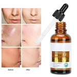 2pcs Castor Oil Essential Oil Face Massage Brightening Tightening Soothing E BST