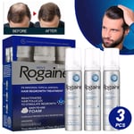 3PCS * 60g Rog for Men Extra Strength Hair Loss & Hair Growth Scalp Foam UK