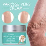 Varicose Veins Cream Spider Leg Cream For Phlebitis Angiitis Improve Blood C Blw