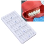 30Pcs Tooth Replacement Kit Porcelain Veneers Teeth Whitening Kit For Home