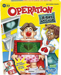 Operation X-Ray Match Up Board Game for 2 or More Players Classic Family