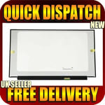 NEW 15.6" GLOSS FHD IPS SCREEN FOR OMEN BY HP LAPTOP 15-DC0093TX