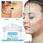 Strong Removal Melasma Whitening Cream    Dark Spot Remover Freckle Speckle