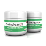 Skincleanze Breakout Cream Fast Acting for Acne, Blackheads & Spots (Pack of 2)