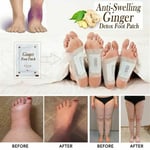 Weight Loss Anti-Swelling Improve Sleep  Foot Care Ginger Extracts Foot Patches