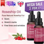 20ML🌟 Organic Rosehip Oil for Face, use of Scars, Stretch Marks & Wrinkles ✅🔥