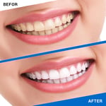 2 Teeth Whitening Strips Dental Whitener Stickers Teeth Care For Teeth Stai Gfl