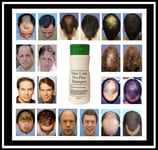 "Hair Loss Pro Plus®" STIMULATING HAIR LOSS REGROWTH SHAMPOO 300ml