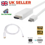 Mini 2M DisplayPort DP to HDMI Male Thunderbolt Adapter Cable For MacBook 1080P