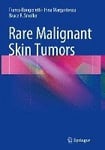 Rare Malignant Skin Tumors