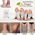 Anti-Swelling Weight Loss Foot Care Improve Sleep Foot Patches Ginger Extracts