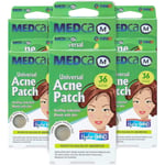 Acne Care Pimple Patch Absorberande lock-Hydrokolloidbandage (108 Count)