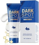 Dark Spot Remover for Face and Body: Corrector for Age Spots Sun Spots Freckles