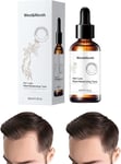 Shelure Hair Growth Oil, Shelure Hair Regrowth Treatment, Nourishes the Scalp Oi