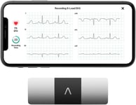 KardiaMobile 6-Lead Personal ECG Monitor - Six Views of The Heart - Detects...