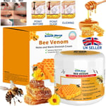 30g Bee Venom Skin Tag Removal Treatment Cream For Body Care Mole Corn Wart UK